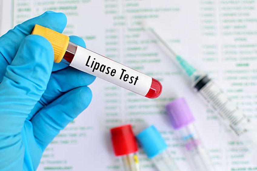 lipasi Lipasi pancreatica: cos'è, quali sono i valori e perché è importante misurarli